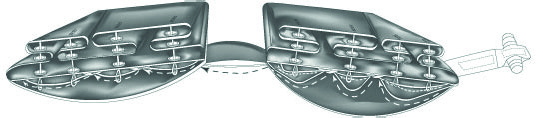 ../images/image71.jpeg